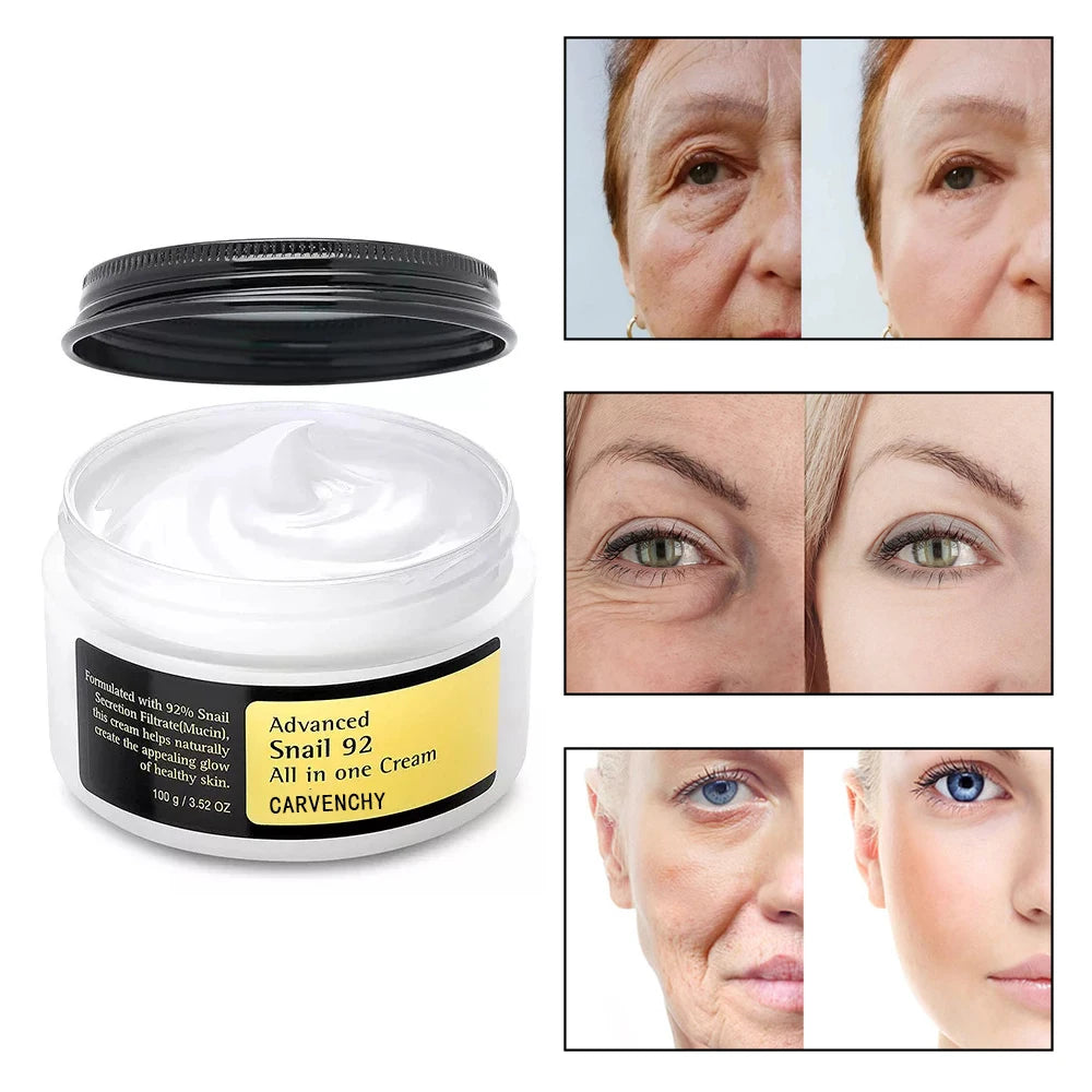 100ml Schnecken mucin Kraft Reparatur Essenz, Gesichts creme feuchtigkeit spendende Serum schrumpfen Poren Akne-Behandlung Reparatur beschädigte Gesichts pflege