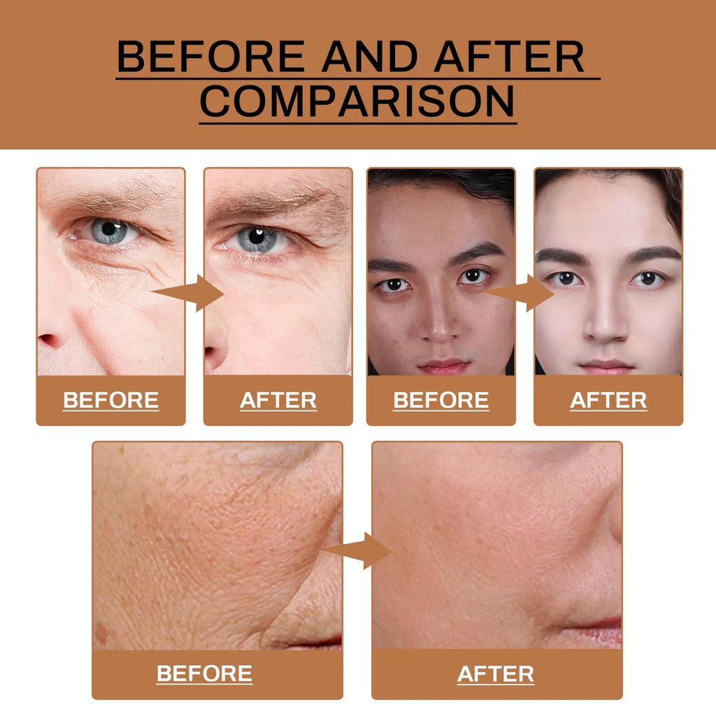 Feuchtigkeitsspendendes Gesichtsserum für Herren, tief feuchtigkeitsspendende, straffende Essenz zur Reduzierung feiner Linien und zur Verbesserung der strahlenden Haut, Anti-Aging-Pflege